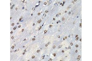 Immunohistochemistry of paraffin-embedded Mouse brain using PSMB10 Polyclonal Antibody at dilution of 1:200 (40x lens).