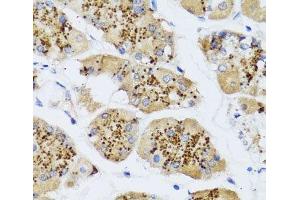 Immunohistochemistry of paraffin-embedded Human stomach using CHIC2 Polyclonal Antibody at dilution of 1:100 (40x lens). (CHIC2 anticorps)