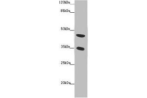 Western blot All lanes: TENT5C antibody at 2 μg/mL + Mouse heart tissue Secondary Goat polyclonal to rabbit IgG at 1/10000 dilution Predicted band size: 45 kDa Observed band size: 45, 35 kDa (FAM46C anticorps  (AA 1-391))