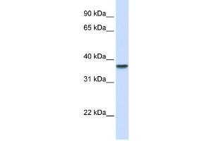 Western Blotting (WB) image for anti-Dimethylarginine Dimethylaminohydrolase 1 (DDAH1) antibody (ABIN2459821) (DDAH1 anticorps)