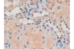 Detection of ADRM1 in Human Kidney Tissue using Polyclonal Antibody to Adhesion Regulating Molecule 1 (ADRM1) (ADRM1 anticorps  (AA 2-407))