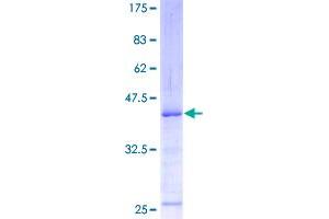 Image no. 1 for Ataxia Telangiectasia Mutated (ATM) (AA 1-138) protein (GST tag) (ABIN1345994)