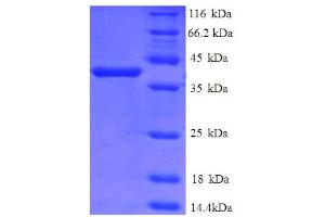 SDS-PAGE (SDS) image for Cathepsin D (CTSD) (AA 67-403), (partial) protein (His tag) (ABIN5712209)