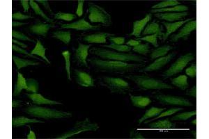 Immunofluorescence of purified MaxPab antibody to ProSAPiP1 on HeLa cell. (ProSAPiP1 anticorps  (AA 1-673))