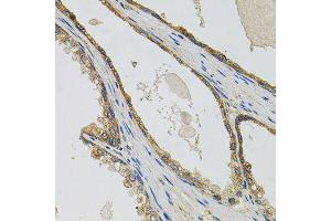 Immunohistochemistry of paraffin-embedded human prostate using PTK7 antibody (ABIN6003571) at dilution of 1/100 (40x lens).