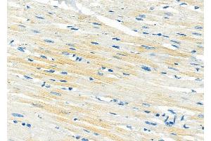 ABIN6261395 and ABIN6279383 at 1/100 staining Rat heart tissue by IHC-P.