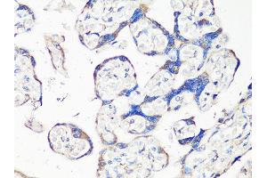 Immunohistochemistry of paraffin-embedded human placenta using MMP2 Antibody (ABIN5998246) at dilution of 1/100 (40x lens). (MMP2 anticorps)