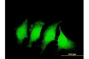 Immunofluorescence of monoclonal antibody to IL1B on HeLa cell.