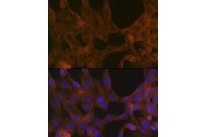 Immunofluorescence analysis of NIH-3T3 cells using B Rabbit mAb (ABIN1678826, ABIN3015929, ABIN3015930 and ABIN7101463) at dilution of 1:100 (40x lens).