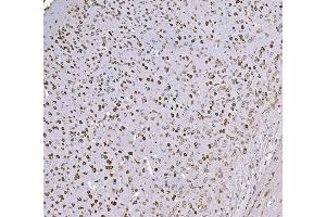 IHC analysis of SND1 using anti-SND1 antibody (ABIN7600526). (SND1 anticorps  (AA 20-204))