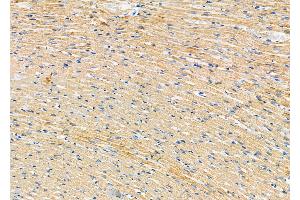 ABIN6263471 and ABIN6278039 at 1/100 staining Rat heart tissue by IHC-P.