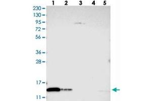 Western blot analysis of Lane 1: RT-4, Lane 2: U-251 MG, Lane 3: Human Plasma, Lane 4: Liver, Lane 5: Tonsil with TXNDC17 polyclonal antibody .