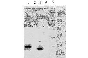 anti-Human Papilloma Virus 18 E7 (HPV-18 E7) (AA 1-35), (N-Term) antibody