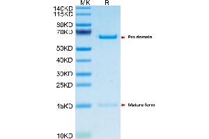 Mouse PCSK9 on Tris-Bis PAGE under reduced condition.
