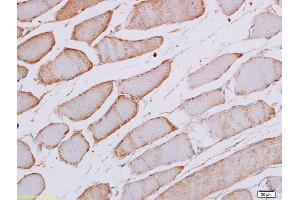 Formalin-fixed and paraffin embedded rat skeletal muscle labeled with Anti Phospho-SEK1/MKK4 (Thr261) Polyclonal Antibody, Unconjugated (ABIN702745) at 1:200 followed by conjugation to the secondary antibody and DAB staining (MAP2K4 anticorps  (pThr261))