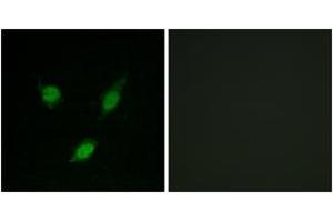 Immunofluorescence analysis of MCF7 cells, using TACC1 Antibody. (TACC1 anticorps  (AA 11-60))