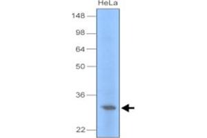 Western blot analysis of cell lysate of HeLa (30 ug) were resolved by SDS - PAGE , transferred to PVDF membrane and probed with UNG monoclonal antibody , clone k1C12 (1 : 1000) . (UNG anticorps)