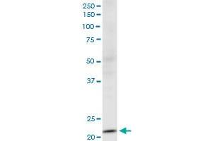NDUFV2 monoclonal antibody (M03), clone 1A10.