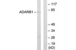 Western blot analysis of extracts from HepG2 cells, using ADARB1 Antibody.