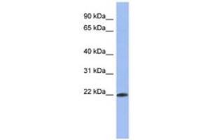 Image no. 1 for anti-RNA Binding Motif Protein 38 (RBM38) (C-Term) antibody (ABIN6743016) (RBM38 anticorps  (C-Term))