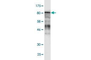 Western Blot detection against Immunogen (106. (MCM5 anticorps  (AA 1-734))