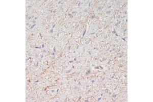 Immunohistochemistry of paraffin-embedded rat brain using Dopamine Transporter/SLC6 antibody (ABIN7270474) at dilution of 1:200 (40x lens).