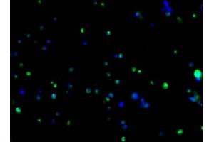 Immunofluorescence staining of 293F transfected cells with ABIN7193151 at 1:100, counter-stained with DAPI. (HA-Tag anticorps)