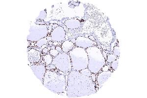 Thyroid gland with strong TTF1 staining of follicular epithelial cells (Recombinant NKX2-1 anticorps)