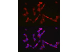 Immunofluorescence analysis of SH-SY5Y cells using ALK antibody  at dilution of 1:200. (ALK anticorps  (AA 19-300))