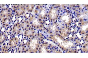 Detection of Bcl2L in Rat Kidney Tissue using Polyclonal Antibody to B-Cell CLL/Lymphoma 2 Like Protein (Bcl2L)