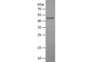 Western Blotting (WB) image for Meningioma Expressed Antigen 5 (Hyaluronidase) (MGEA5) (AA 1-209) protein (His-IF2DI Tag) (ABIN7123912)