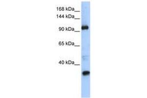Image no. 1 for anti-Terminal Uridylyl Transferase 1, U6 SnRNA-Specific (TUT1) (AA 829-878) antibody (ABIN6740612) (TUT1 anticorps  (AA 829-878))