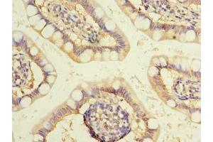 Immunohistochemistry of paraffin-embedded human small intestine tissue using ABIN7175757 at dilution of 1:100 (WDR49 anticorps  (AA 251-500))