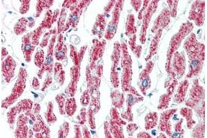 Human Heart (formalin-fixed, paraffin-embedded) stained with ACO2 antibody ABIN462115 followed by biotinylated goat anti-rabbit IgG secondary antibody ABIN481713, alkaline phosphatase-streptavidin and chromogen. (ACO2 anticorps  (AA 438-467))