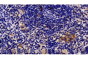 Detection of SQSTM1 in Mouse Spleen Tissue using Polyclonal Antibody to Sequestosome 1 (SQSTM1)