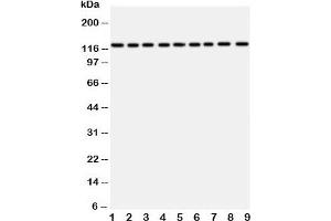Western blot testing of TRPC3 antibody and Lane 1:  rat liver;  2: (r) lung;  3: (r) intestine;  4: (r) ovary;  5: human U87;  6: (h) A549;  7: (h) COLO320;  8: (h) SW620;  9: (h) HeLa (TRPC3 anticorps  (AA 836-851))