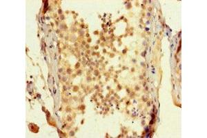Immunohistochemistry of paraffin-embedded human testis tissue using ABIN7170512 at dilution of 1:100 (SPATA16 anticorps  (AA 238-475))