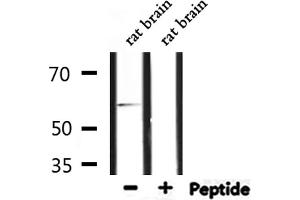 Western blot analysis of extracts from rat brain, using TF2H1 Antibody. (GTF2H1 anticorps  (N-Term))