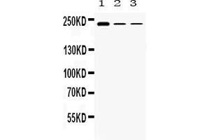 Western blot analysis of TECTA expression in rat testis extract ( Lane 1), HEPA1-6 whole cell lysates ( Lane 2) and HEPG2 whole cell lysates ( Lane 3).