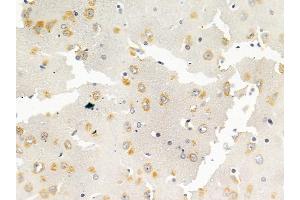 TAK1 Mouse Monoclonal Antibody at 1/100 staining rat brain tissue by IHC-P.