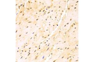 Immunohistochemistry of paraffin-embedded mouse esophagus using SRSF1 Antibody.