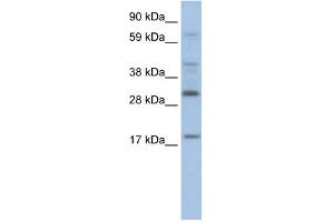 WB Suggested Anti-PYCARD Antibody Titration:  2. (PYCARD anticorps  (Middle Region))