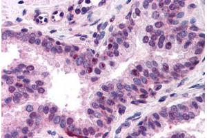 Human Prostate (formalin-fixed, paraffin-embedded) stained with NFYA antibody ABIN218318 at 1:400 followed by biotinylated goat anti-rabbit IgG secondary antibody ABIN481713, alkaline phosphatase-streptavidin and chromogen. (NFYA anticorps  (N-Term))