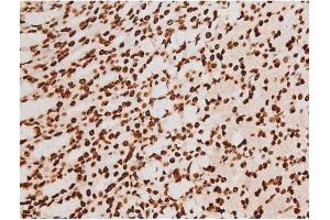 ABIN6267604 at 1/200 staining Rat ganstric tissue sections by IHC-P.