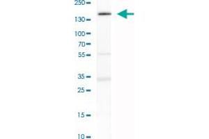 Western Blot analysis of SH-SY5Y cell lysate with TULP4 polyclonal antibody . (TULP4 anticorps)