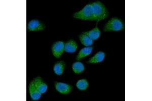 anti-Autocrine Motility Factor Receptor (AMFR) (AA 553-643) antibody
