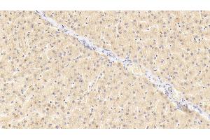 Detection of GRN in Human Liver Tissue using Polyclonal Antibody to Granulin (GRN) (Granulin anticorps  (AA 361-585))