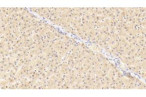 Detection of GRN in Human Liver Tissue using Polyclonal Antibody to Granulin (GRN) (Granulin anticorps  (AA 361-585))