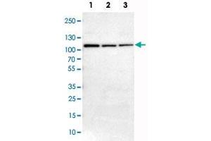 Western Blot analysis of Lane 1: NIH-3T3 cell lysate (mouse embryonic fibroblast cells), Lane 2: NBT-II cell lysate (Wistar rat bladder tumor cells) and Lane 3: PC12 cell lysate (pheochromocytoma of rat adrenal medulla) with AK7 polyclonal antibody . (Adenylate Kinase 7 anticorps)