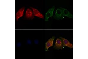 ABIN7094110 and ABIN7098154 staining Hela cells by IF/ICC. (CALU anticorps  (Internal Region))